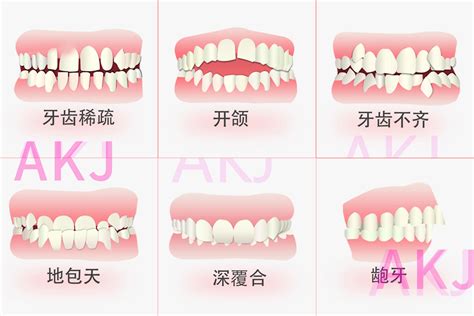 大牙位置|正常的大牙图片